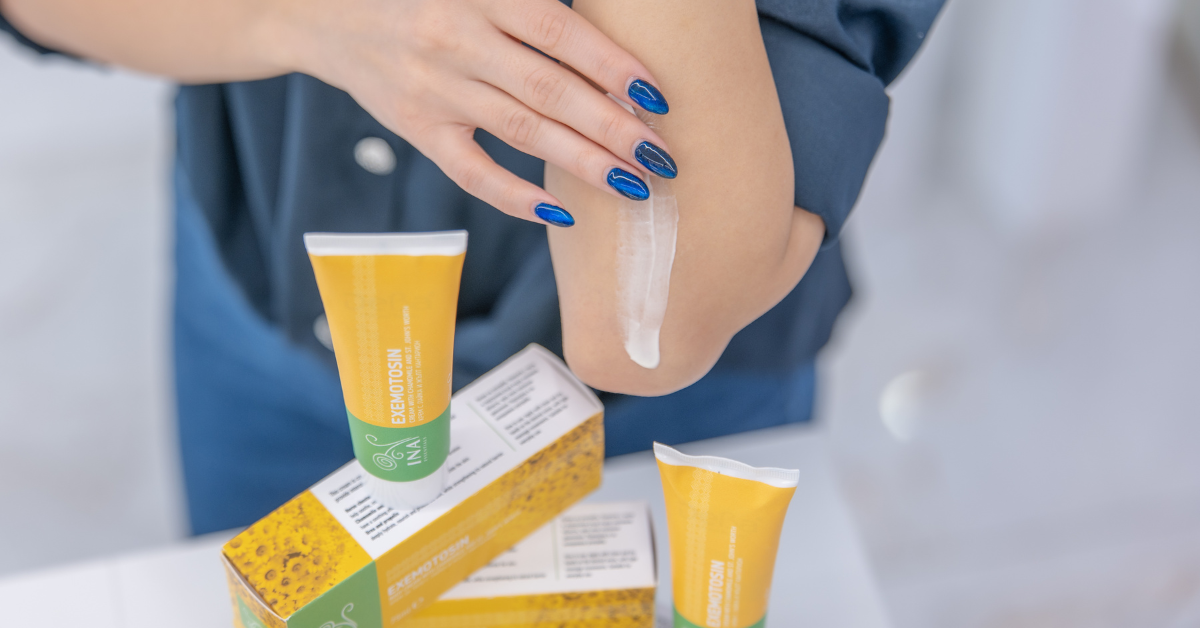 Allergisches Ekzem und Kontaktdermatitis natürliche Pflege mit InaEssentials Creme