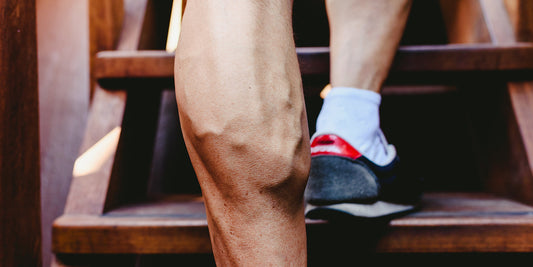 Gut sichtbare Krampfadern an den Wadenmuskeln – wie Fitness helfen oder schaden kann