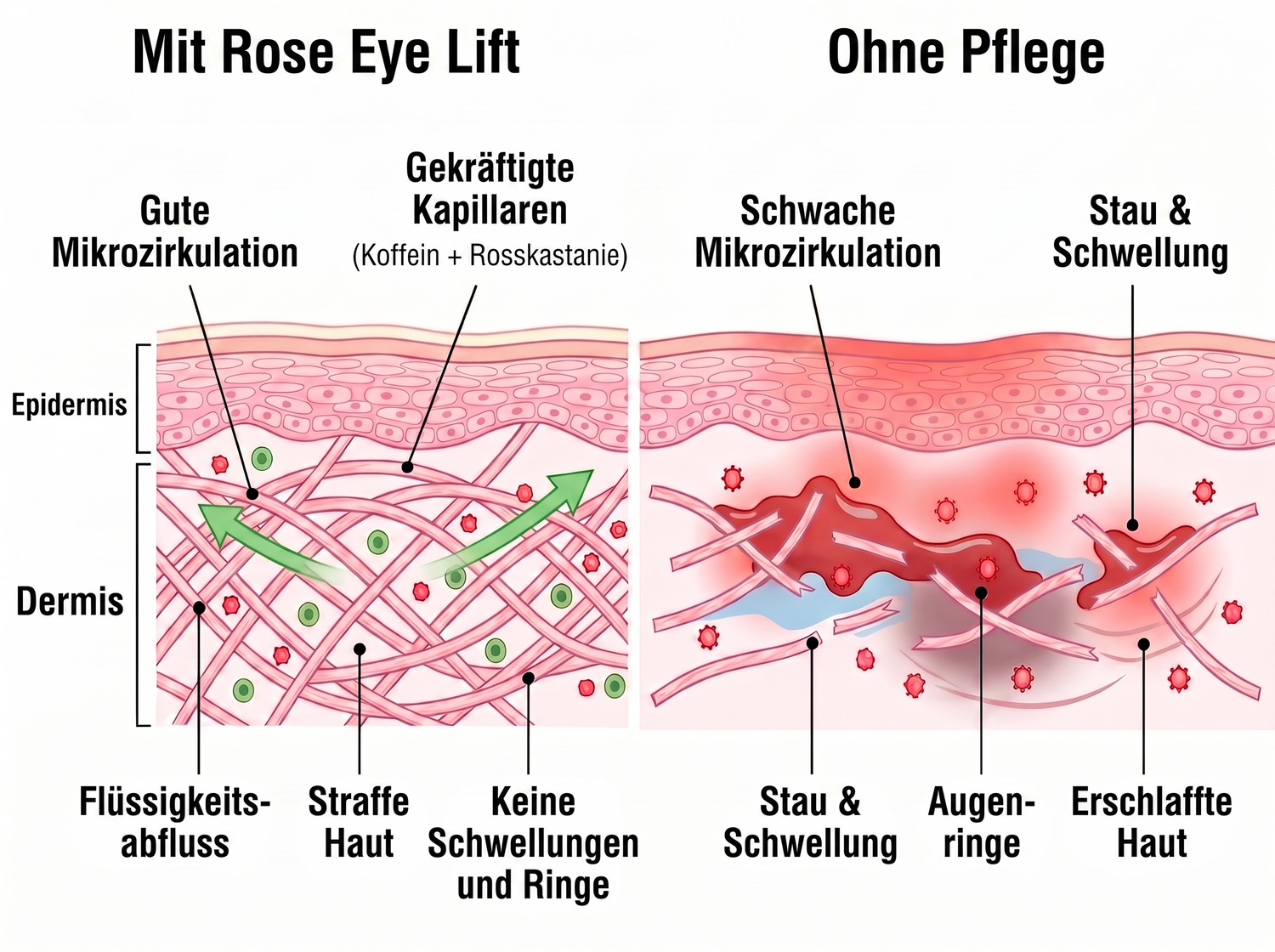 Rose Eye Lift DE t17