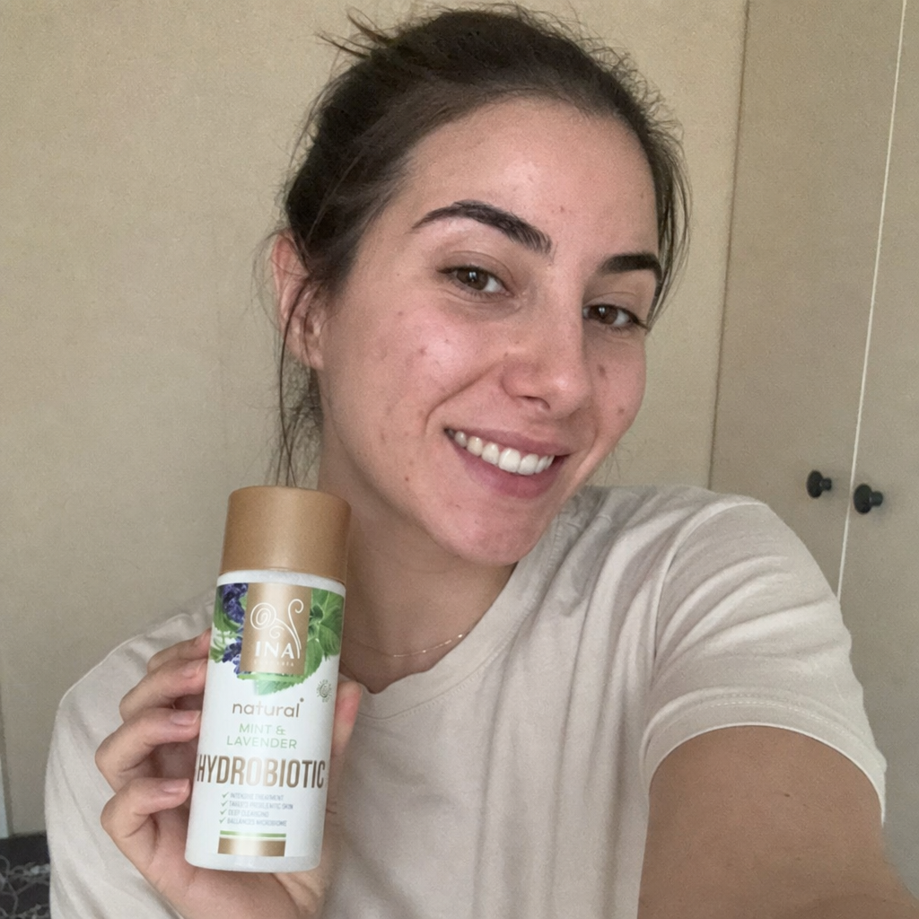 acne DE keep
